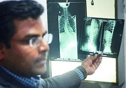 Five Lakh to be paid to a woman by doctors & hospital for leaving a needle in her spine 20 years ago